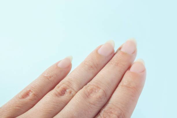 istock Nails without nail polish. Manicure without coating. 1000103922