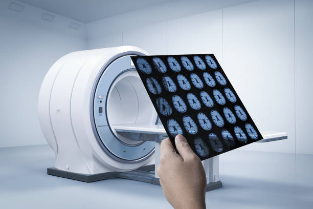 x-ray film with mri scan - brain mri scan alzheimers disease medical scan imagens e fotografias de stock