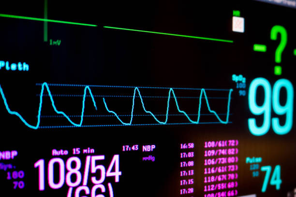 istock Normal heart function on pulse oximeter pleth graph bar on monitor display 1000508220
