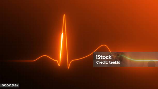Heart Rate Monitor Stock Photo - Download Image Now - Electrocardiography, Taking Pulse, Listening to Heartbeat