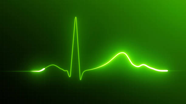 monitor de la frecuencia cardíaca - human heart surveillance computer monitor pulse trace fotografías e imágenes de stock