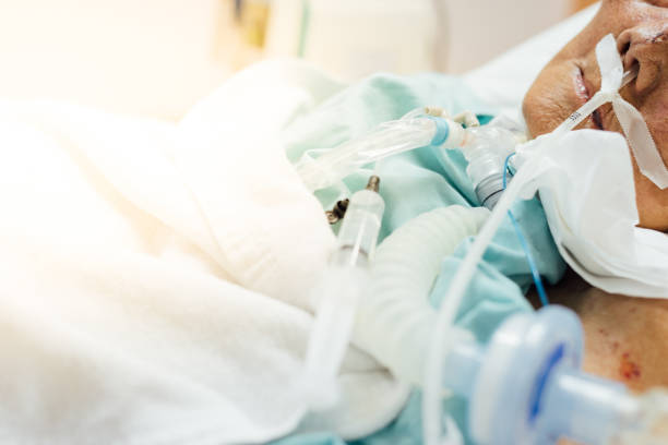 istock Patient do tracheostomy and ventilator in hospital 1000656954