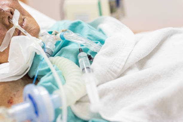 istock Patient do tracheostomy and ventilator in hospital 1000656984