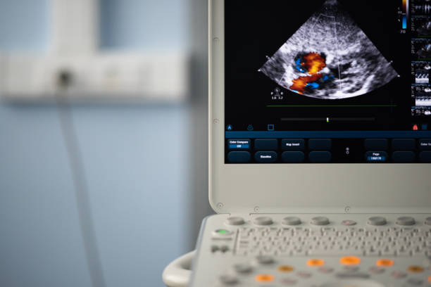 istock Screen modern ultrasound scanner with the image of interatrial communication. 1000830956