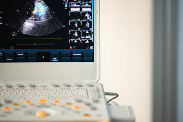 Image of a modern ultrasonic scanner with a keyboard and a monitor. Screen, control panel and keyboard of modern ultrasound scanner after cardiac examination. aorta photos stock pictures, royalty-free photos & images