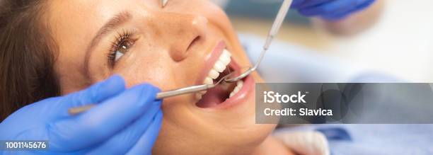 Woman At The Dentist Stock Photo - Download Image Now - Dentist, Dental Health, Dental Equipment