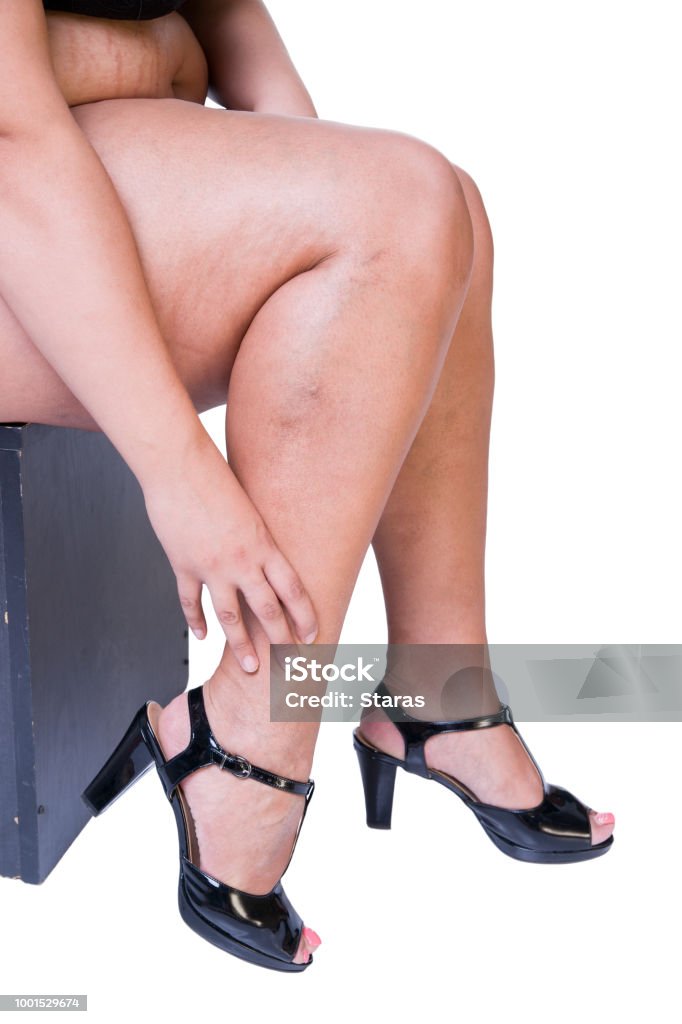 Plus Size Model In Black High Heels Shoes Fat Woman Isolated On White  Background Legs Fatigue Stock Photo - Download Image Now - iStock
