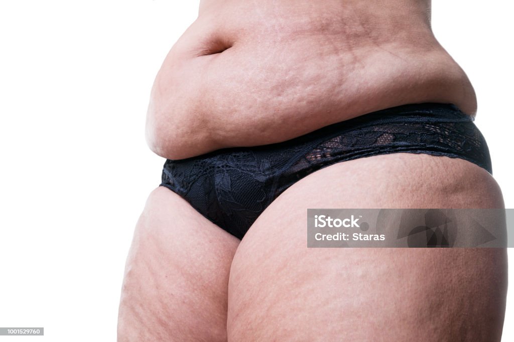 Fat Woman Belly Overweight Close Exercise Stock Photo 1325950292