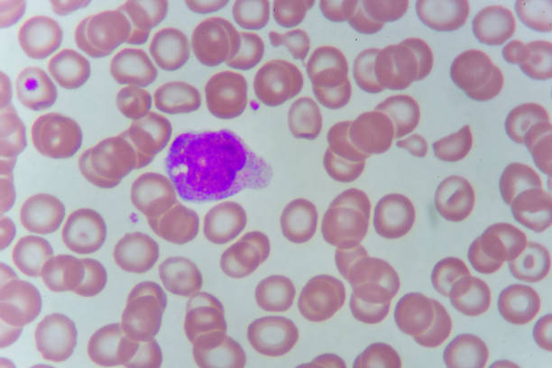 istock White blood cells in blood smear 1001617792