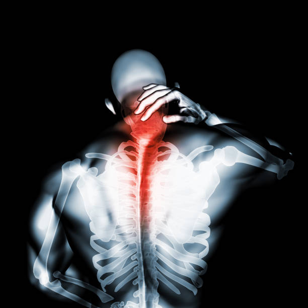 istock Neck painful - cervical spine skeleton x-ray, 3D illustration. 1002786808