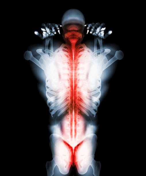 istock 3D Illustration of sacral and cervical painful. 1002786870