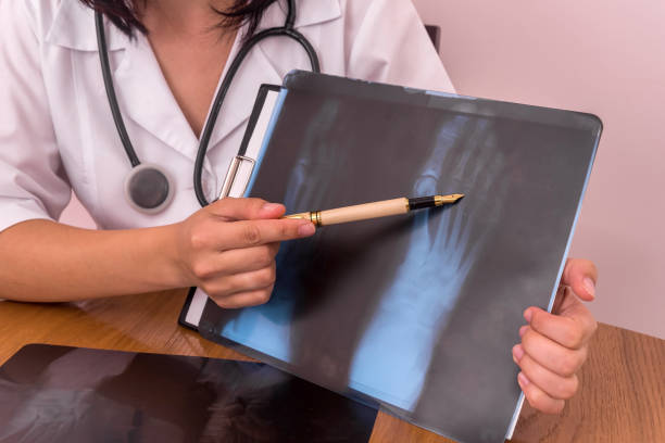istock Doctor's hands with x-ray of a patient and pen 1002859564