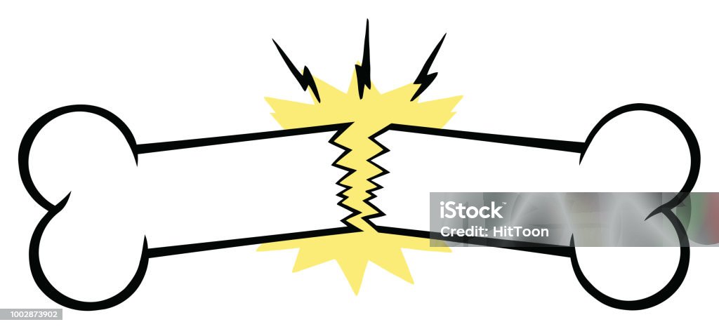 Broken Bone Line Cartoon Drawing Design Stock Illustration - Download Image Now - Adult, Anatomy, Arm - iStock Broken Bone Line Cartoon Drawing Design Stock Illustration - Download Image Now - Adult, Anatomy, Arm - iStock