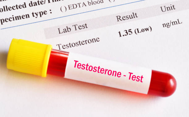 Abnormal low testosterone hormone test result Abnormal low testosterone hormone test result with blood sample tube estrogen photos stock pictures, royalty-free photos & images