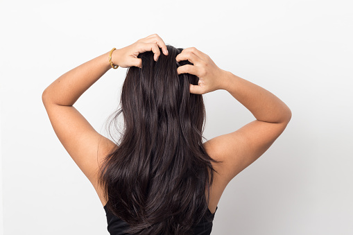 Las mujeres picazón del cuero cabelludo pelo dañado, concepto de cuidado del cabello. photo