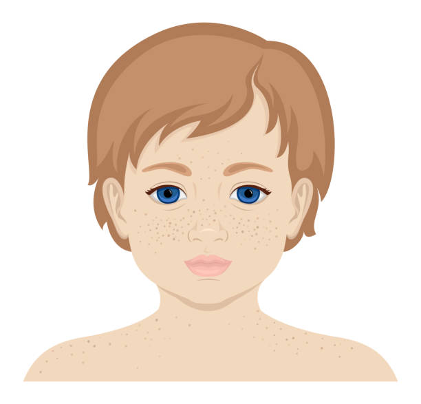 маленькая девочка с веснушками - freckle stock illustrations