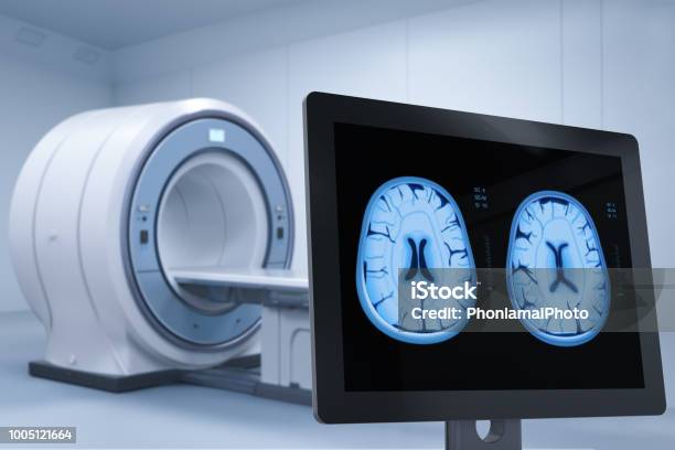 Monitor Display Xray Brain Stock Photo - Download Image Now - Analyzing, Anatomy, Bed - Furniture