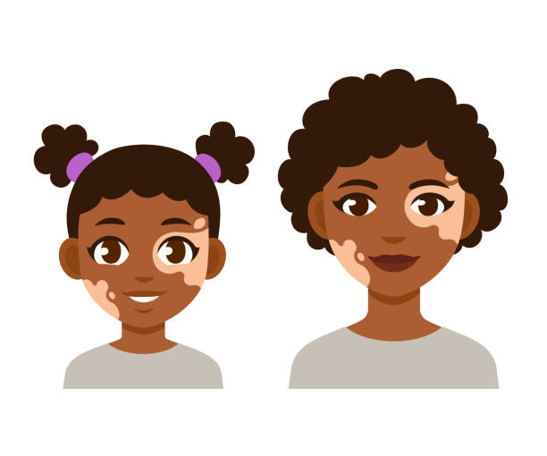 Adult and child with vitiligo Adult woman and child with vitiligo. Cute cartoon black girl character, vector illustration. vitiligo stock illustrations