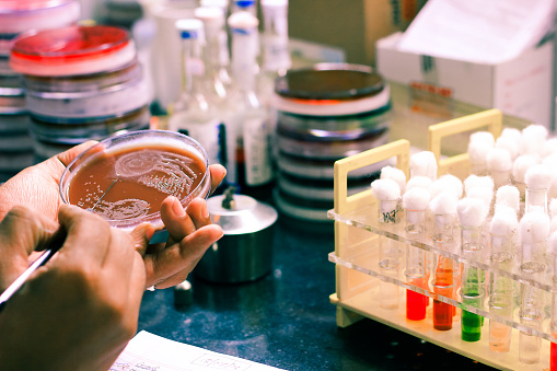 Plate Inoculation Bacterial Inoculation On A Culture Plate Using Inoculation Loop By ...