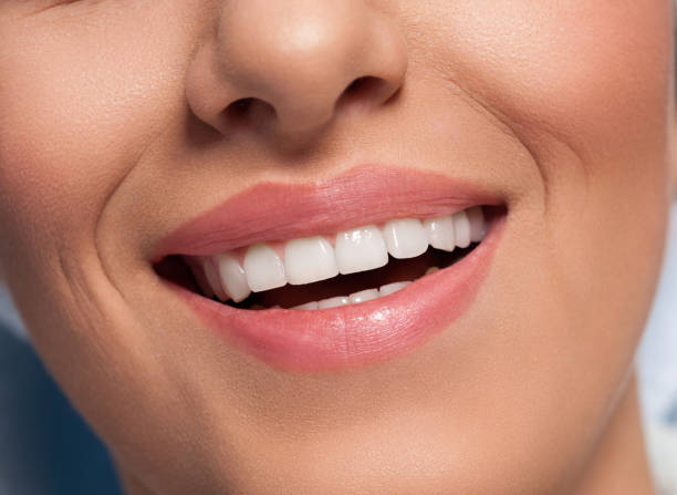 istock Close up of beautiful healthy smile 1006197344