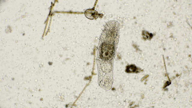 the worm species of Oligochaeta, Aeolosomatidae family under the microscope
