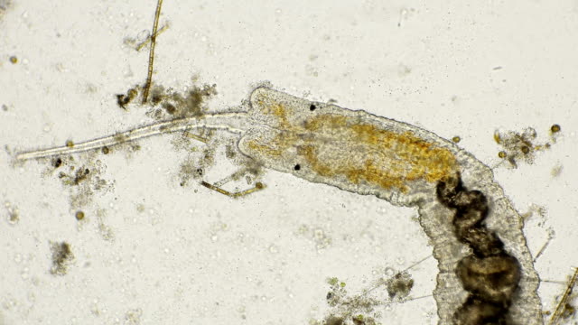 worm of the family Naididae, Pristina longiseta under the microscope