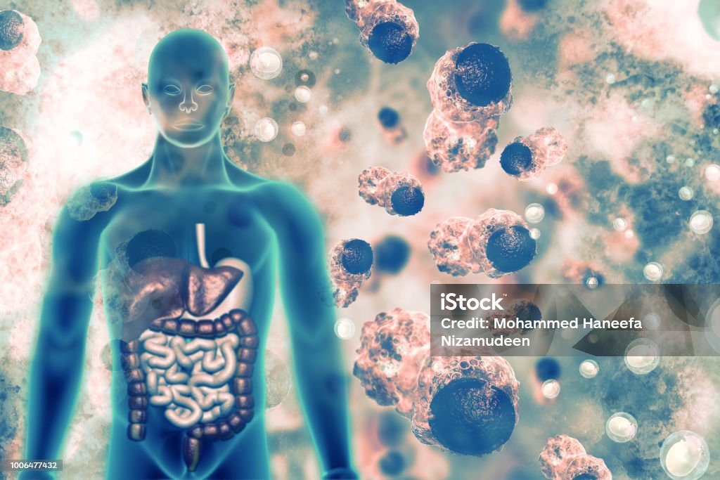 Cancer cells Immune System Stock Photo