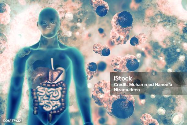 Cancer Cells Stock Photo - Download Image Now - Immune System, The Human Body, Cancer Cell