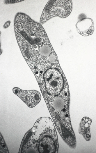 Electron microscopy of Trypanosome blood parasite
