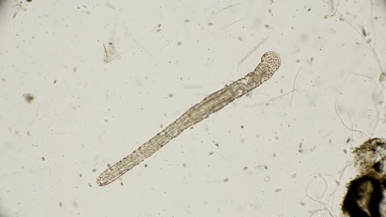 worm of the family Aeolosomatidae, Aeolosoma hemprichi, under the microscope