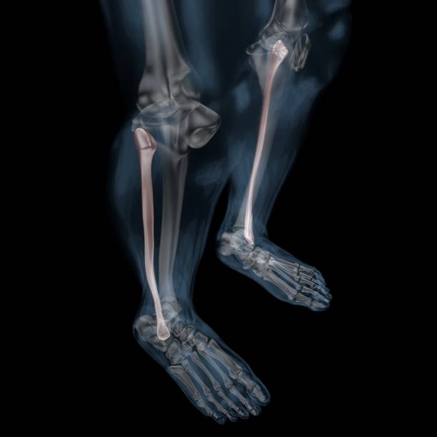 istock 3D illustration of skeletal Fibula 1007399394