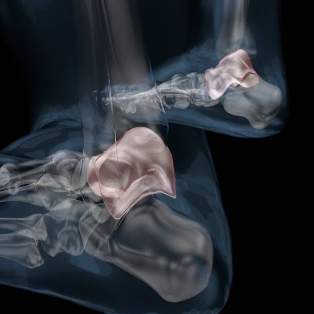 istock 3D illustration of skeletal Malleolus 1007400094