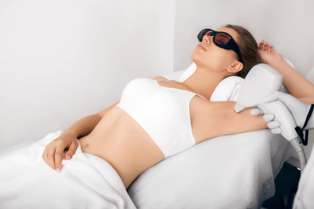 epilazione laser sotto le ascelle, depilazione - waxing armpit women beauty treatment foto e immagini stock