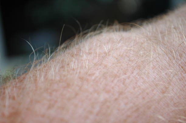 istock Human skin with hair 1007415760