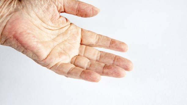 istock older womans hand on white background 1007698460