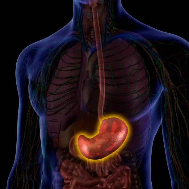Photo of Inflamed Stomach in Male Internal Anatomy