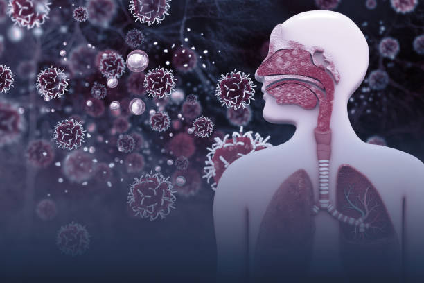 istock Cancer cells infected the Human Respiratory System 1008346272
