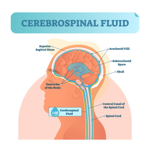 Cerebrospinal fluid vector illustration. Anatomical labeled diagram with human superior sigittal sinus, arachnoid Villi, subarachnoid and spinal cord central canal. Cerebrospinal fluid vector illustration. Anatomical labeled scheme with human head and inside of skull. Diagram with superior sigittal sinus, ventricles, arachnoid Villi and spinal cord central canal. stomach-blockage stock illustrations