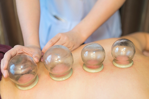Closeup for hand of Therapist giving cupping treatment to young beautiful woman in beauty Spa.(Soft and select focus)