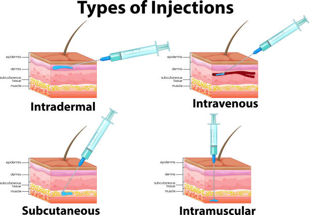 ilustrações de stock, clip art, desenhos animados e ícones de a set of type of injections - injecting