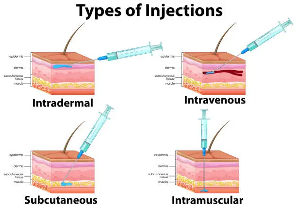 Vector illustration of A Set of Type of Injections