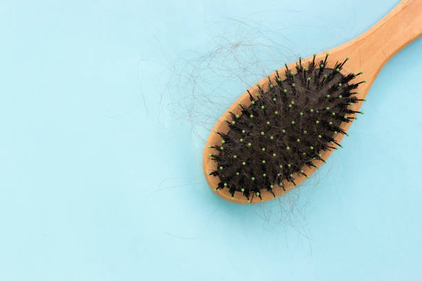 comb with hair on a blue background, the problem of hair loss, the concept of hair care - full hair imagens e fotografias de stock