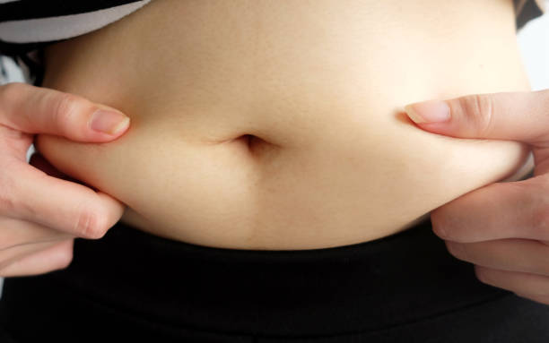 istock woman hand catching fat body belly paunch , diabetic risk factor 1011221108