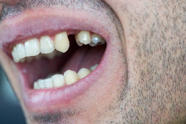 Man Missing Tooth Man Missing Tooth gap toothed photos stock pictures, royalty-free photos & images