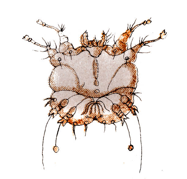 Scabies, also known as the seven-year itch, is a contagious skin infestation by the mite Sarcoptes scabiei Illustration of a Scabies, also known as the seven-year itch, is a contagious skin infestation by the mite Sarcoptes scabiei sarcoptes scabiei stock illustrations