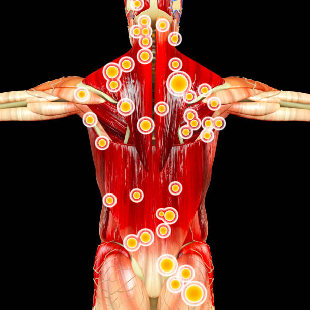 Back view of a man and his trigger points. Anatomy muscles. 3d rendering