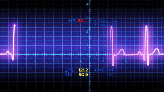 Heart beat chart on the monitor 1 Free Stock Video Footage Download Clips  pulse trace
