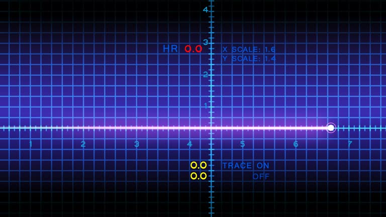 Heart beat chart on the monitor 1 Free Stock Video Footage Download Clips pulse trace Heart beat chart on the monitor 1 Free Stock Video Footage Download Clips pulse trace