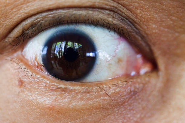 istock Close up dark brown eye. 1012507474