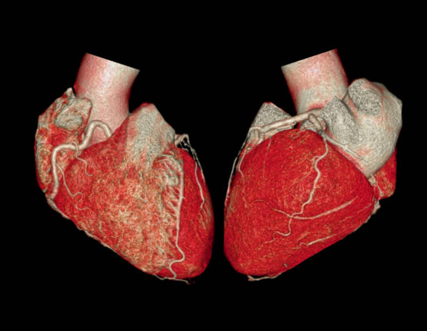 herz form 3d-rendering von ct-scanner. - human heart heart attack x ray image chest stock-fotos und bilder